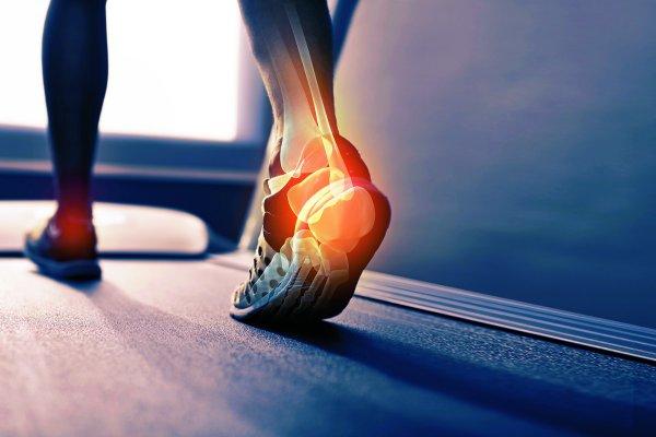 Does CBD Oil Help with Plantar Fasciitis? - Secret Nature